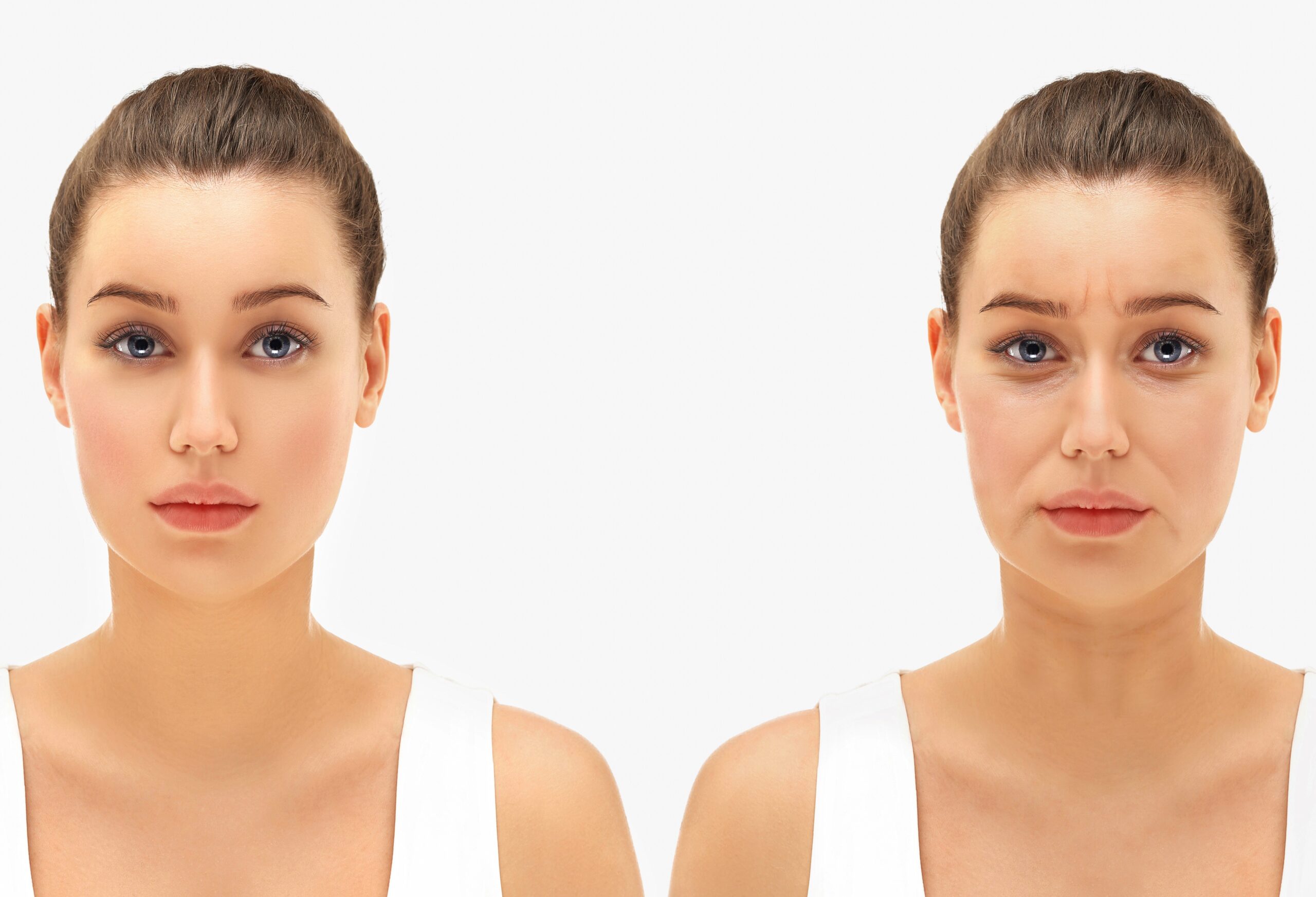 Before and After Hyaluronic Acid Fillers