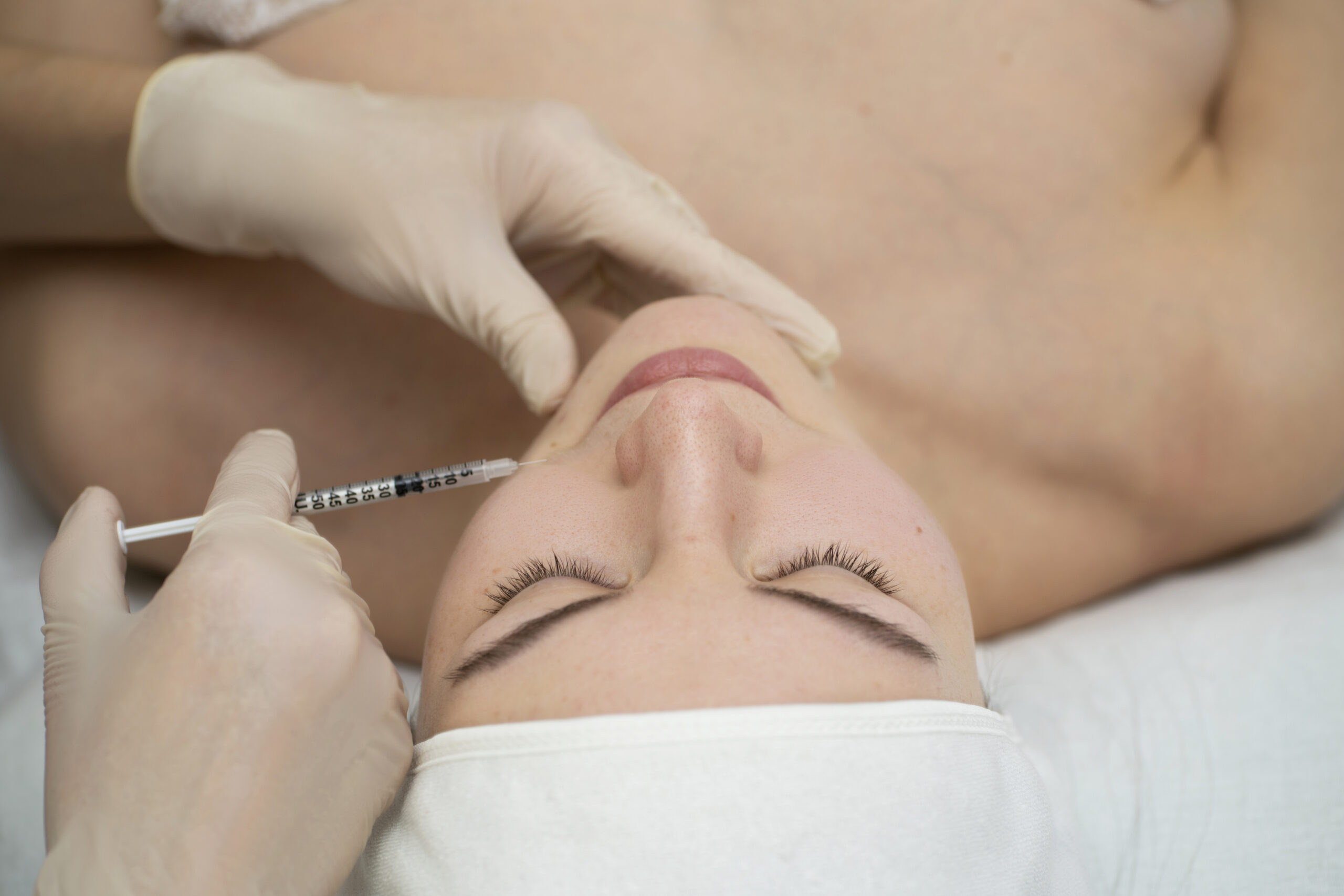 Practitioner injecting Radiesse into cheek area