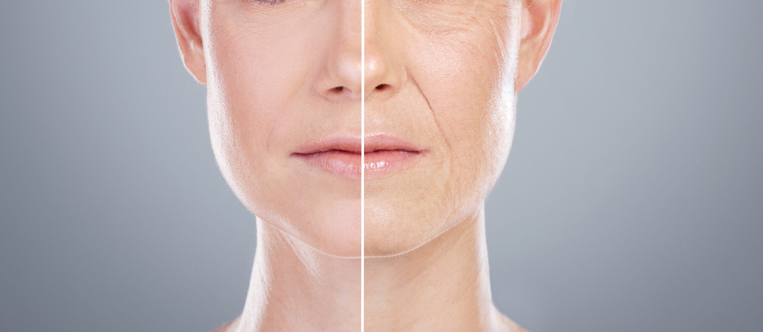 Visible difference in facial volume before and after Sculptra
