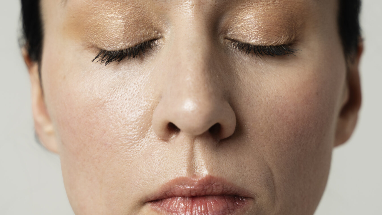 Neuromodulator injection between eyebrows