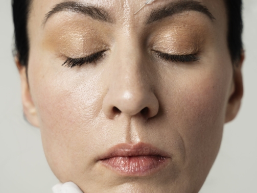 Neuromodulator injection between eyebrows