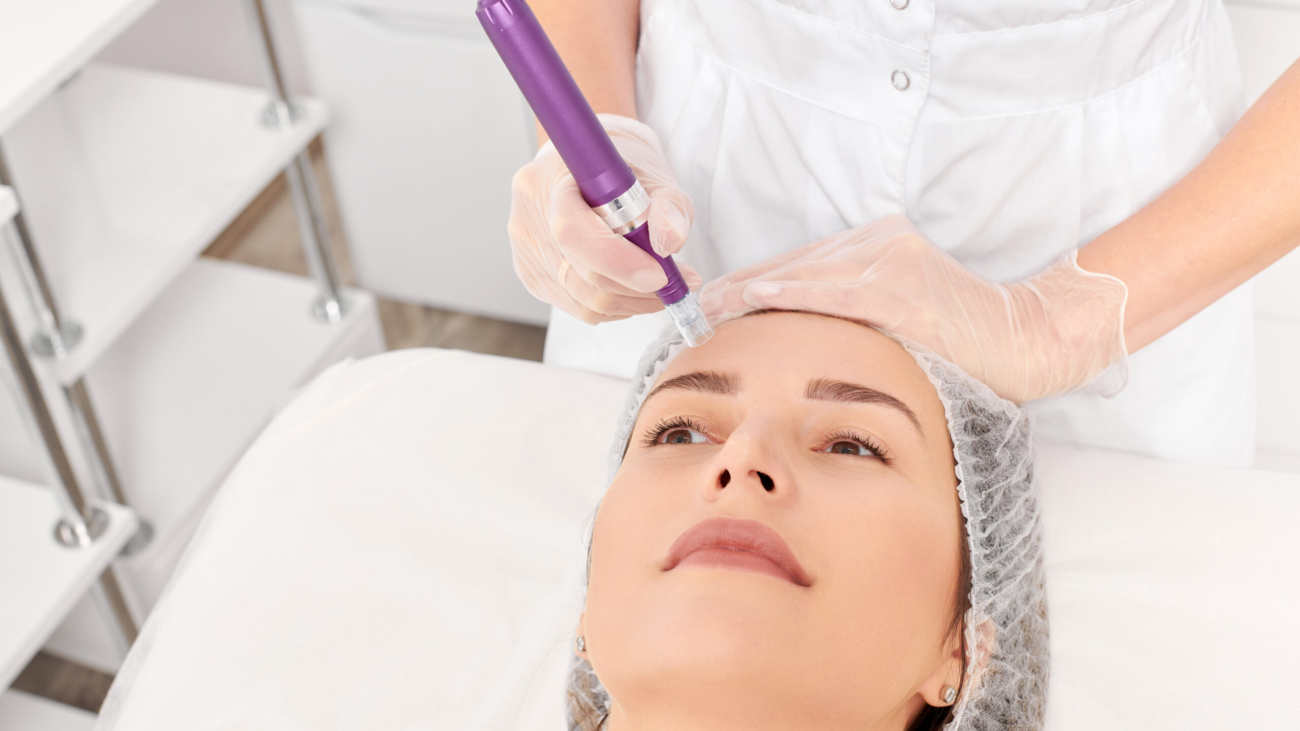 Aesthetician performing microneedling on a client’s face