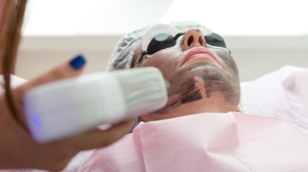 Chemical peel and laser rejuvenation at Reveal Clinics Riyadh for radiant, even-toned skin.