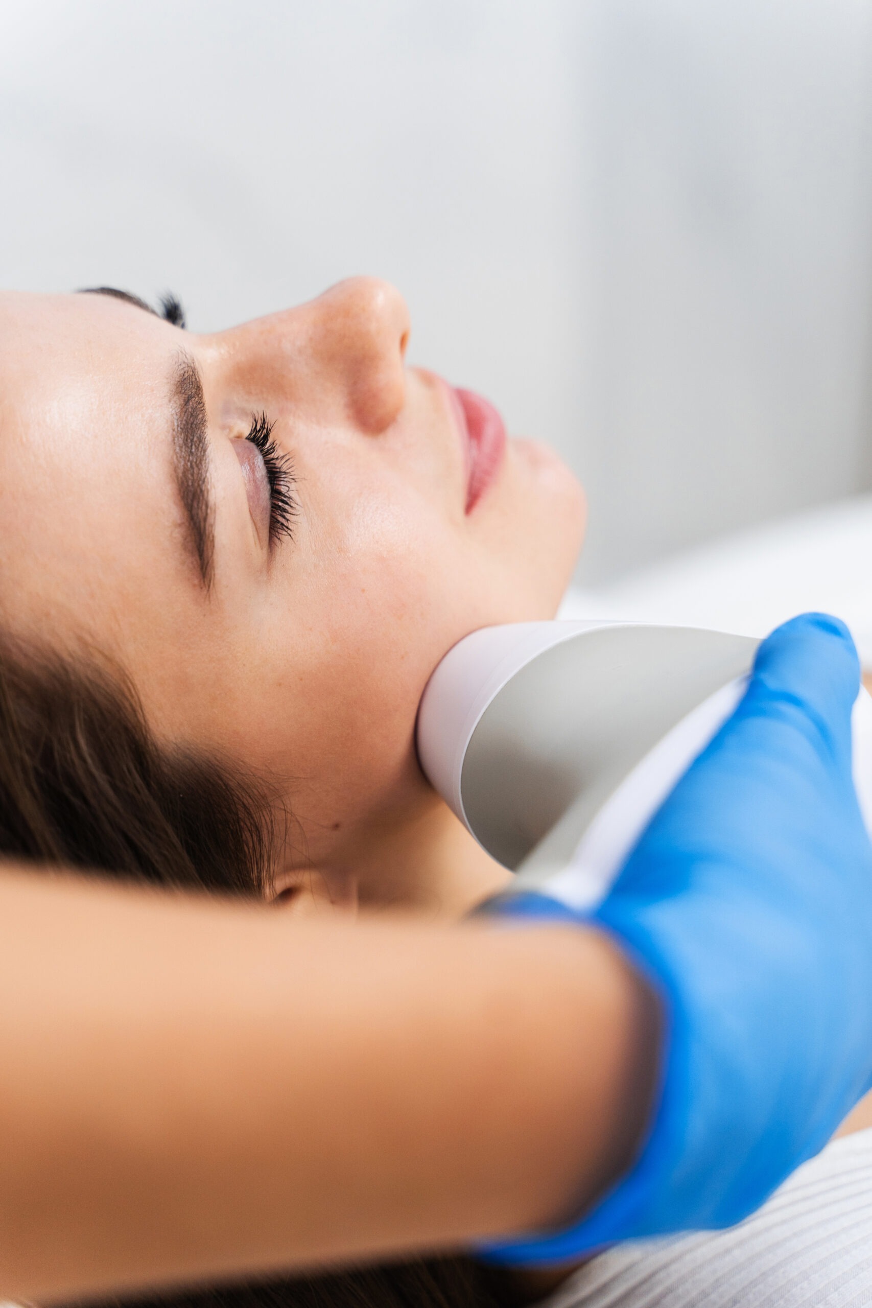 Fraxel laser treatment targeting skin texture and pores