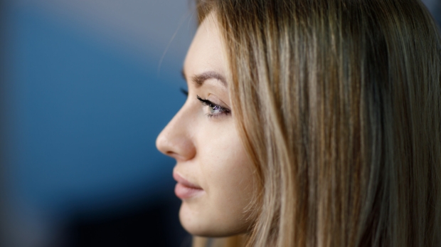 Subtle liquid rhinoplasty enhancing natural facial balance in 2026