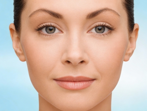 Radiesse filler lifting cheeks and midface naturally