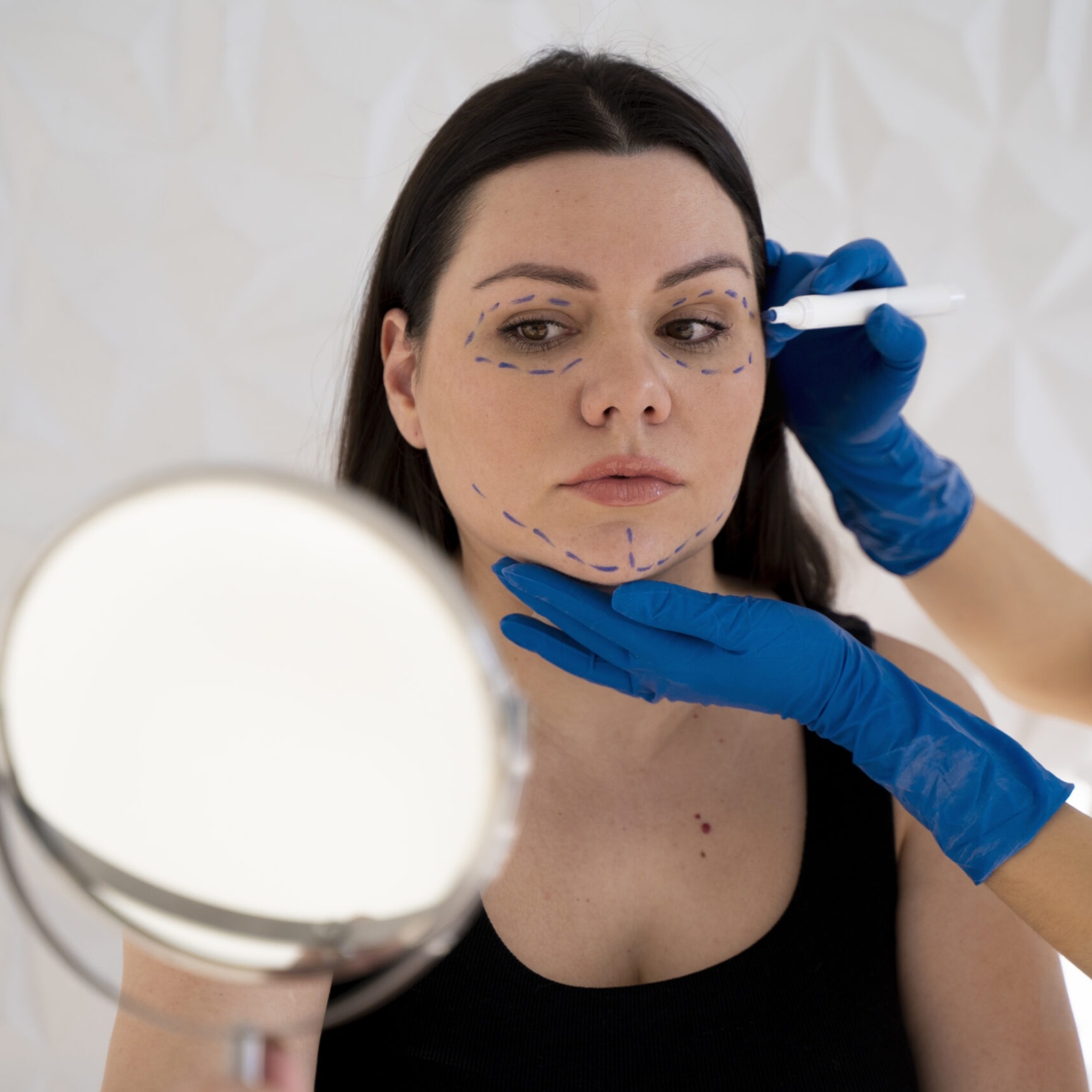 Preventive Botox facial mapping before wrinkles appear