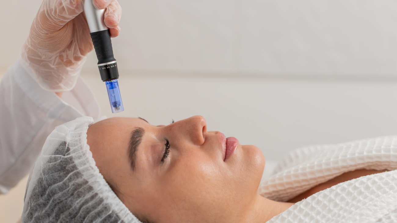 Microneedling treatment on face