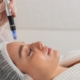 Microneedling treatment on face