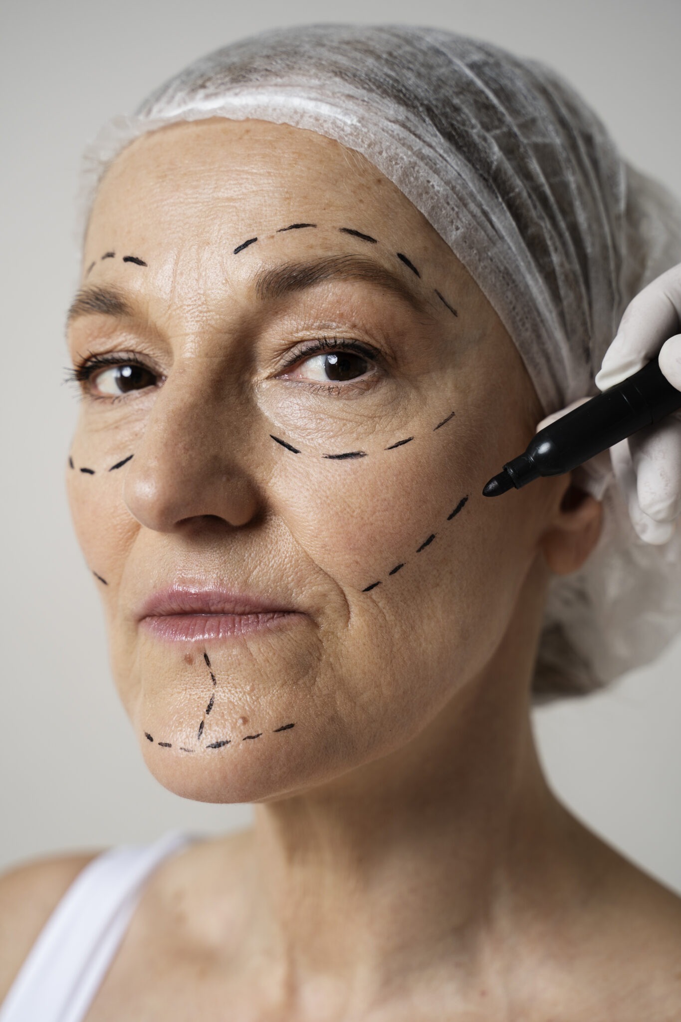 Facial mapping for balanced lip and cheek enhancement