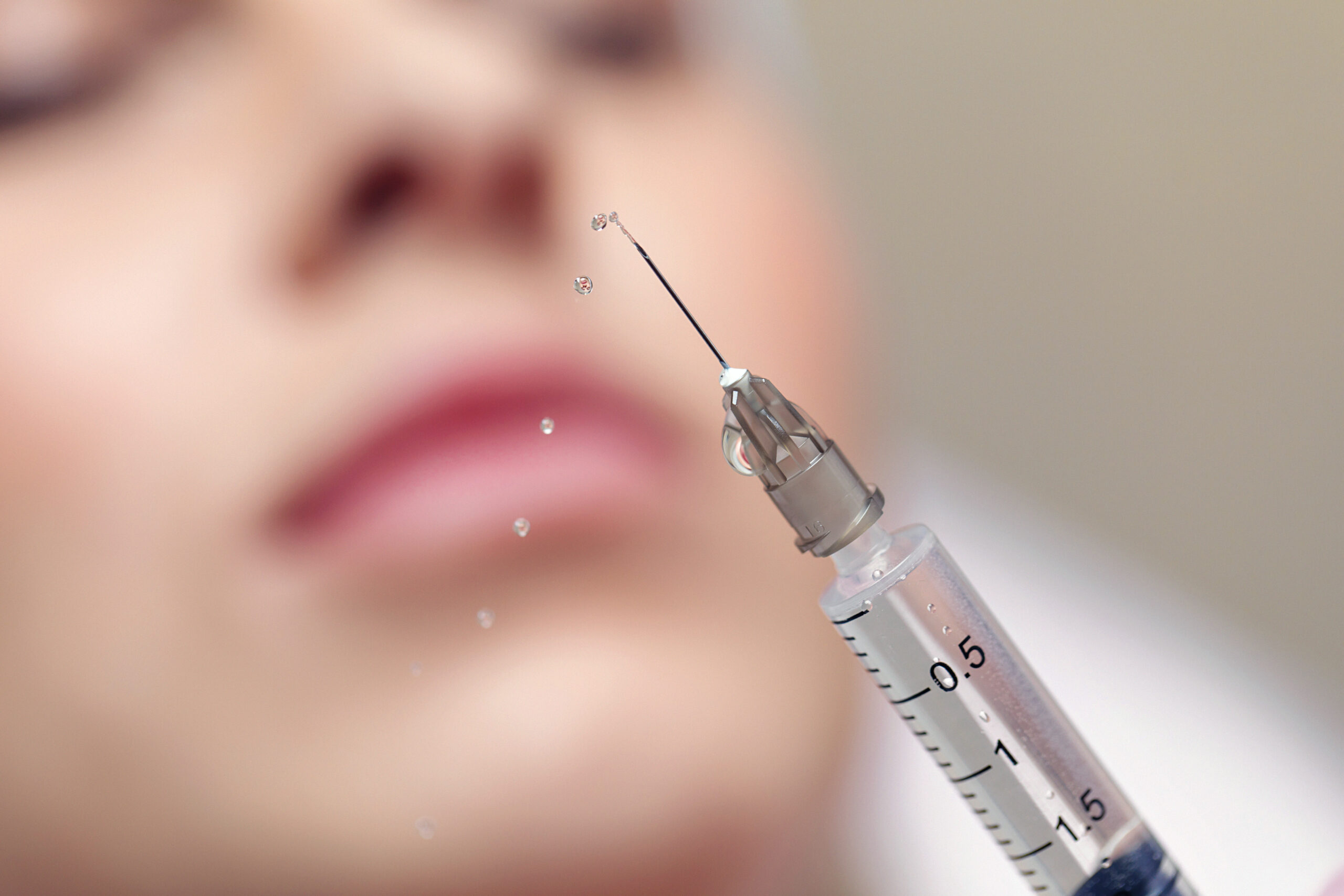 Hyaluronic acid filler treatment for facial hydration