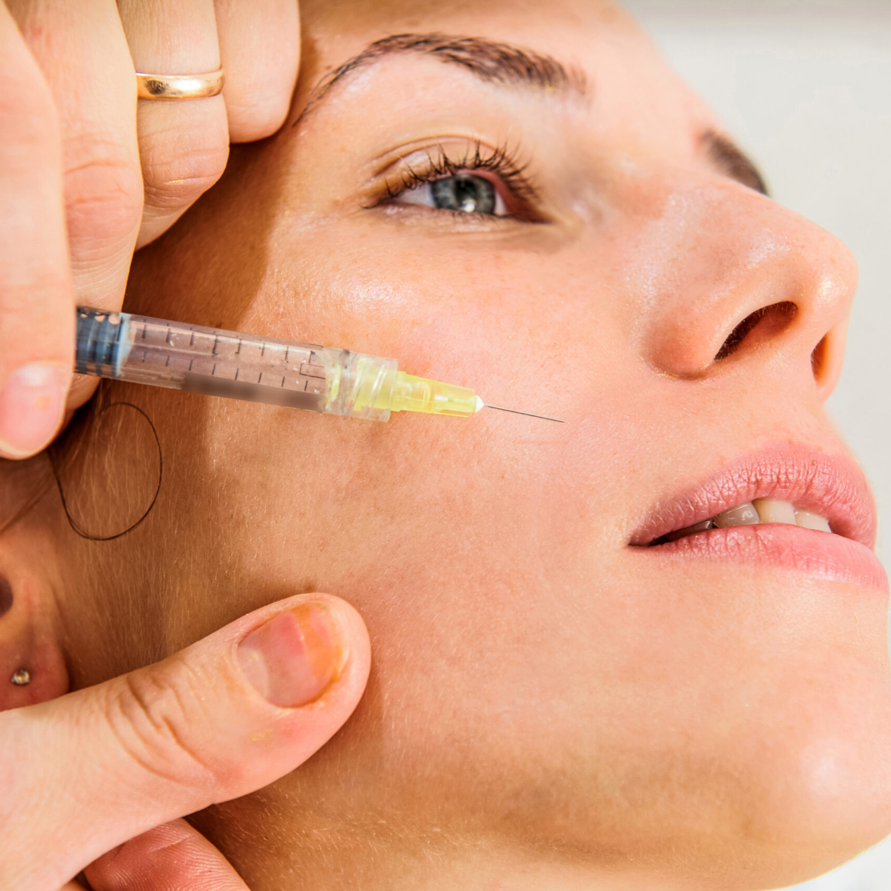 Biostimulatory injectable treatment during Ramadan