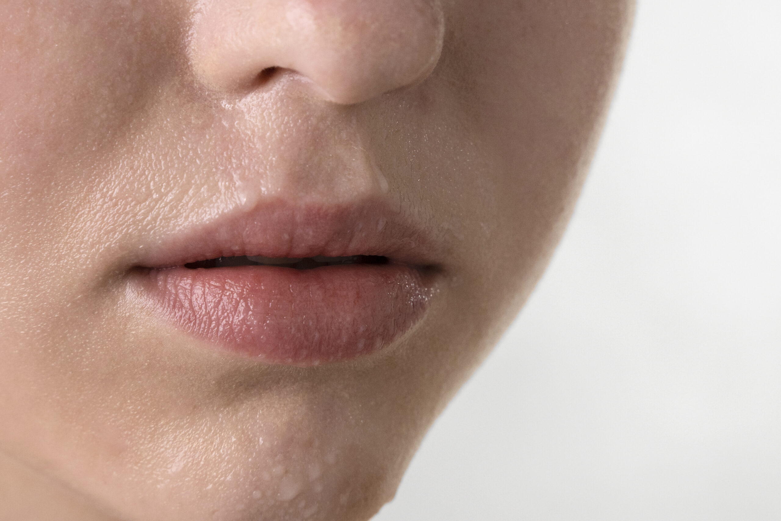 lip filler swelling after treatment